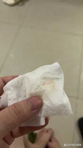 刨腹产后白带有血丝怎么办-第1张图片