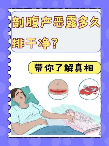 如何促进产后恶露顺利排出-第1张图片