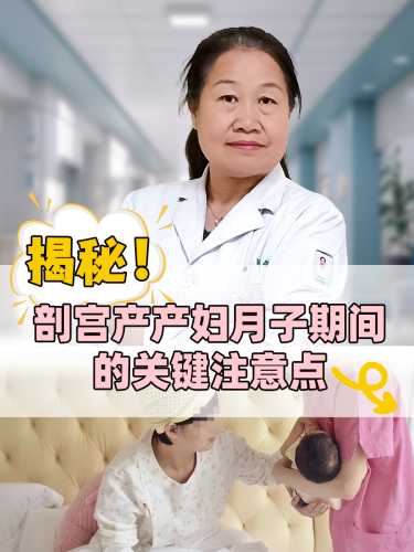 生小剖腹产该注意什么-第1张图片