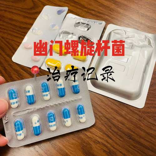 备孕能不能检测幽门螺杆菌-第1张图片