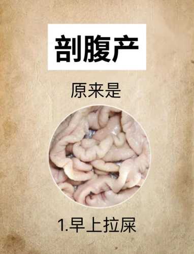 齐鲁医院青岛剖腹产有啥注意-第1张图片