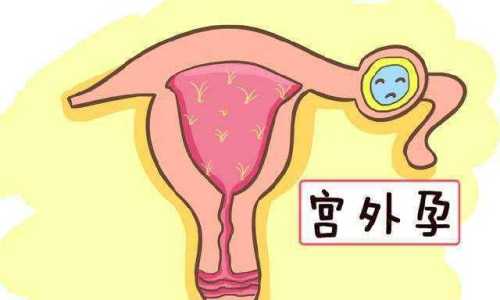 产后两个月突然又见红是咋回事-第1张图片