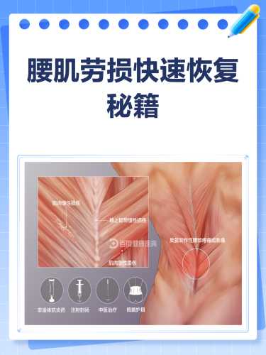 产后腰肌劳损能恢复吗-第1张图片