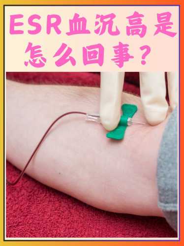 产后红细胞高是什么原因-第1张图片