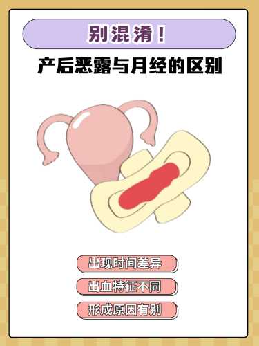 产后差别有哪些-第1张图片