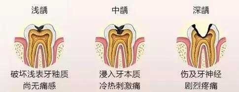 产后多久可以开始刷牙-第1张图片