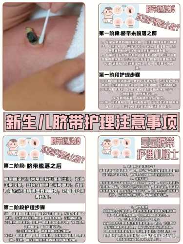 新生儿宝宝如何护理-第1张图片