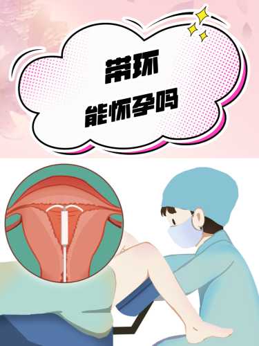 摘环后多久可以成功怀孕-第1张图片