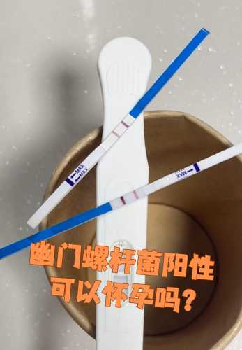 备孕期间能否检测幽门螺杆菌-第1张图片