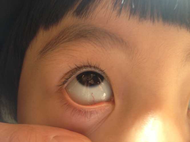 婴儿眼睛能看到什么-第1张图片