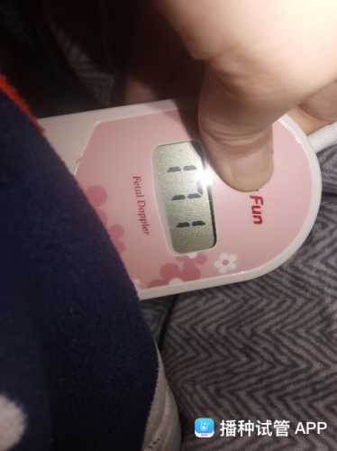 孕十一周孕反仍在正常吗-第1张图片