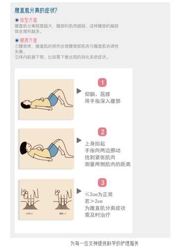 产后腹直肌分离3指怎么办-第1张图片