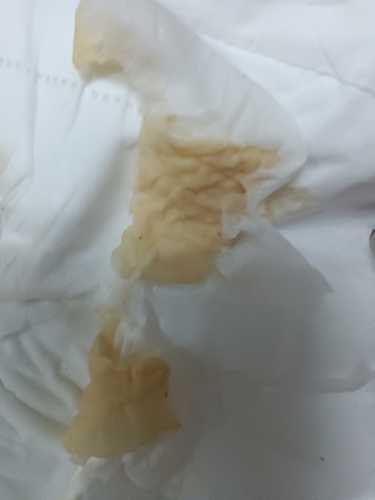 剖腹产有奶吗-第1张图片