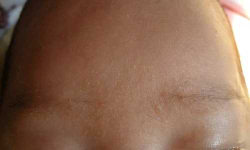 婴儿几个月开始长眉毛-第1张图片