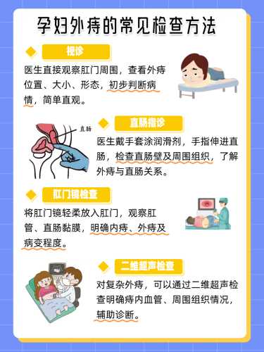 顺产肛门坠胀多久消失-第1张图片