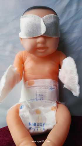 新生儿阴囊水肿是怎么回事-第1张图片