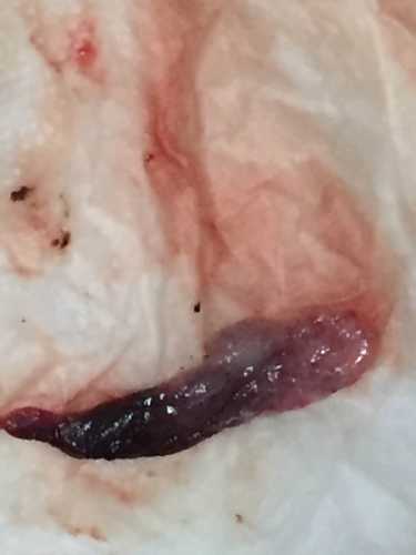 怀孕后能查出流产史吗-第1张图片