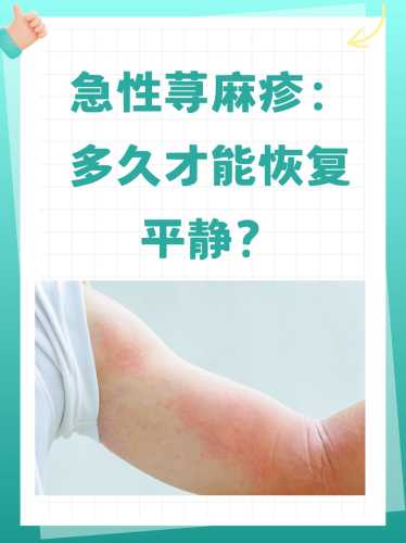 慢性荨麻疹发痒影响备孕吗-第1张图片