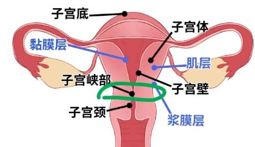 剖腹产划开几层-第1张图片