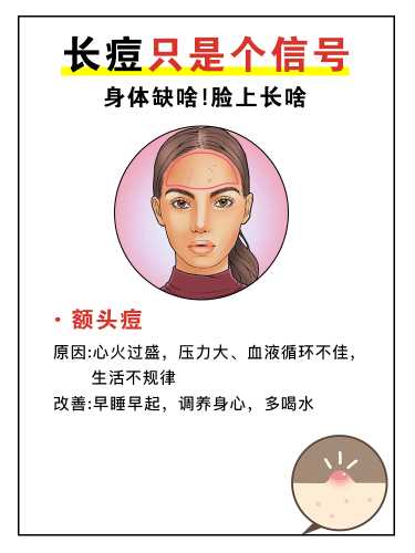 产后脸上长痘痘是怎么回事-第1张图片