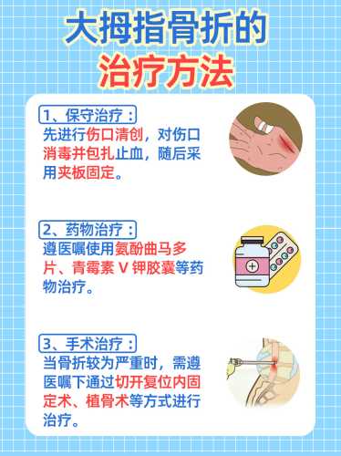 产后大拇指疼怎么办-第1张图片