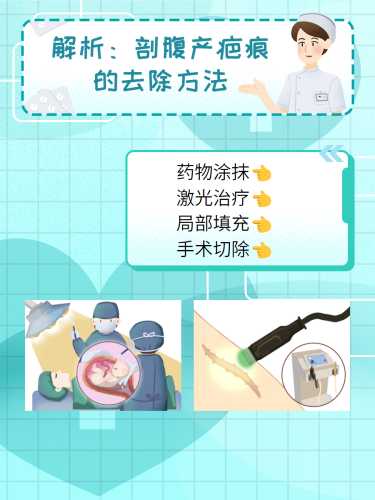 剖腹产刀口如何防止增生-第1张图片