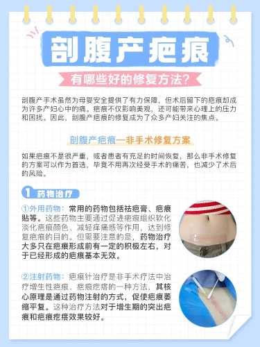 谈固医院剖腹产有啥注意事项-第1张图片