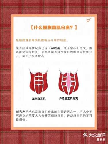 产后腹直肌分离两指咋办-第1张图片