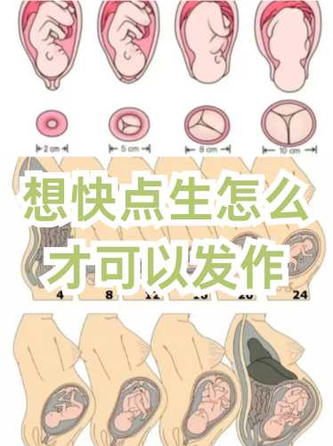 孕妇怎样能顺利实现顺产-第1张图片