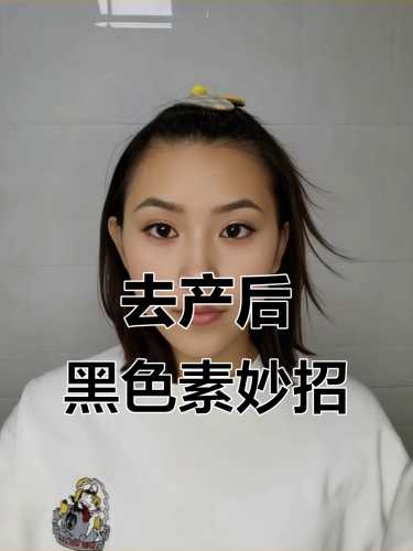 产后黑色素如何消除-第1张图片