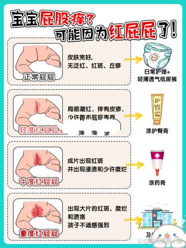 宝宝穿尿不湿总痒是怎么回事-第1张图片