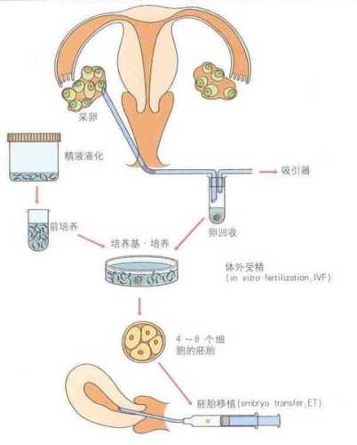 二代试管婴儿费用是多少-第1张图片