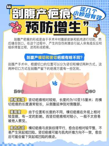 39周了可不可以剖腹产-第1张图片