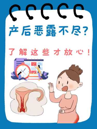 产后第四天恶露正常吗-第1张图片