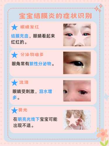 新生儿眼科需要注意什么-第1张图片