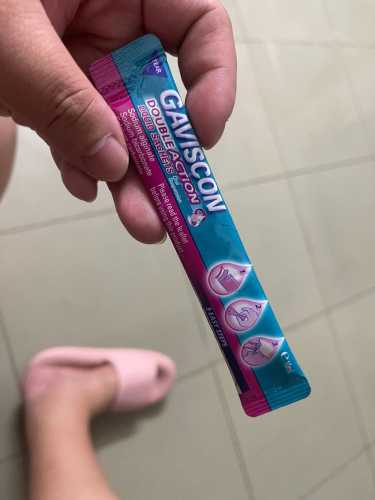 孕反导致眼窝发青是怎么回事-第1张图片