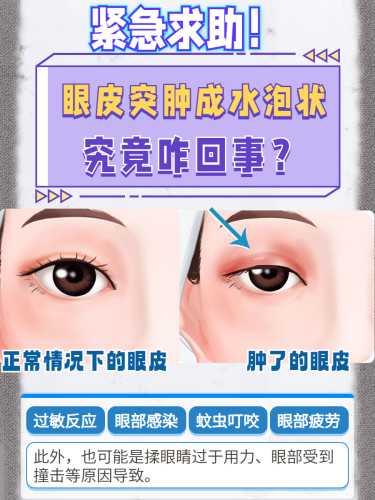 婴儿眼睑肿是怎么回事-第1张图片