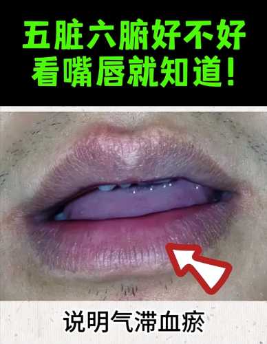 新生儿嘴唇发紫咋回事-第1张图片