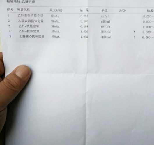 备孕检查乙肝抗体怎么看-第1张图片