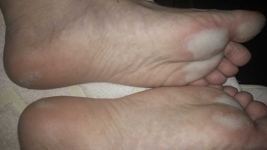 婴儿脚底发白是怎么回事-第1张图片