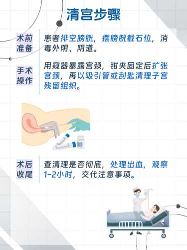 剖腹产打不打麻药-第1张图片