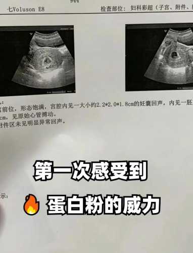 产后能不能喝蛋白粉-第1张图片
