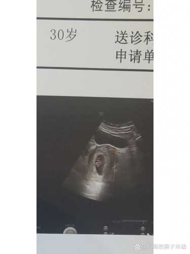 孕4周2天有孕反正常吗-第1张图片