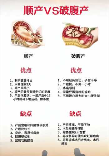 刨腹产和顺产哪个更适合-第1张图片