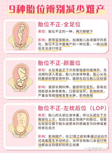 枕右前位能顺产吗-第1张图片