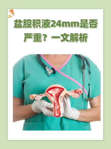 产后盆腔积液是怎么回事-第1张图片