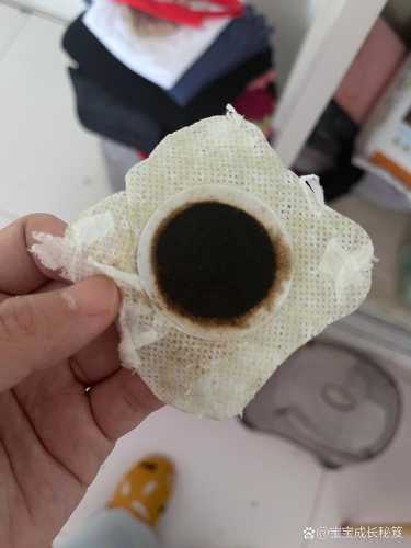 婴儿咳嗽鼻塞怎么办-第1张图片