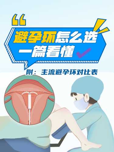 顺产后多久可上环-第1张图片