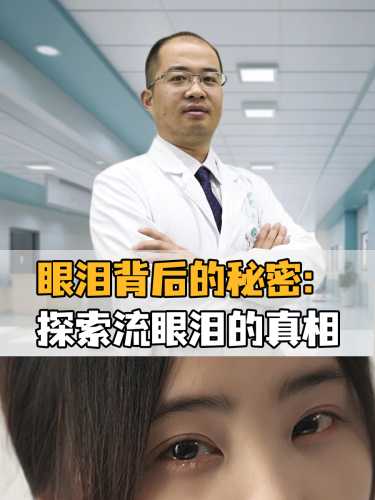 产后泪腺问题该如何解决-第1张图片