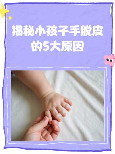 婴儿皮肤干燥脱皮怎么办-第1张图片